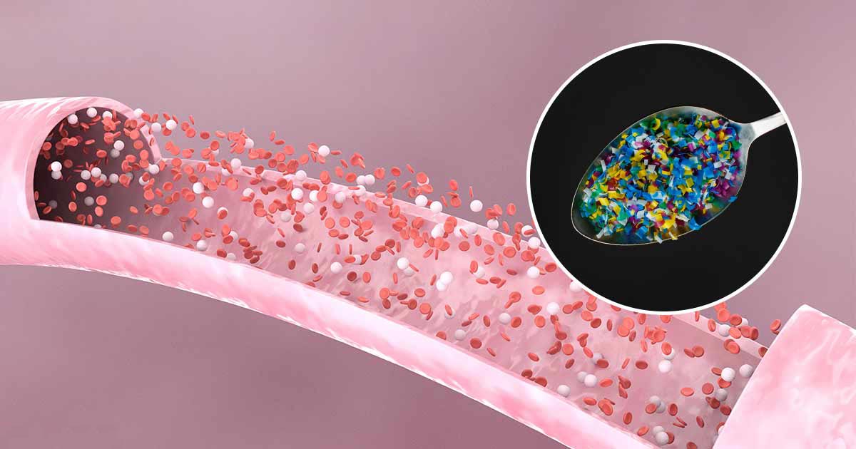 Microplásticos encontrados no sangue humano pela primeira vez