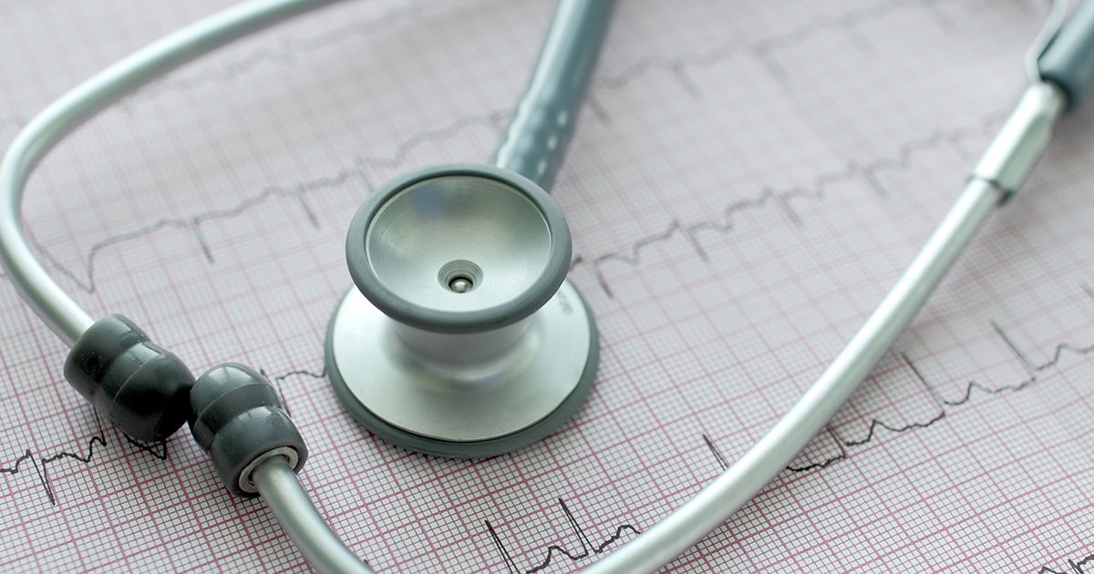 Como identificar a fibrilação atrial e o que pode ajudar