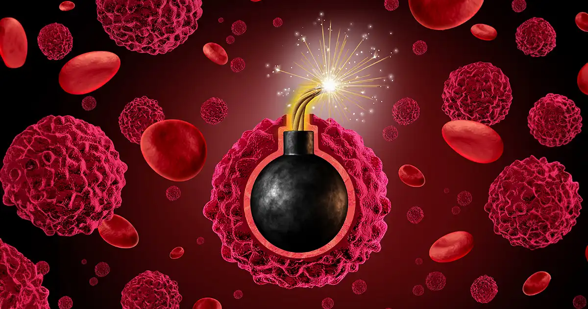 Xarope de milho rico em frutose associado ao crescimento acelerado de tumores