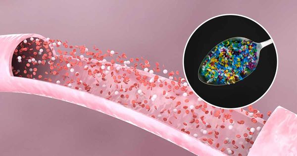 Microplásticos encontrados no sangue humano pela primeira vez