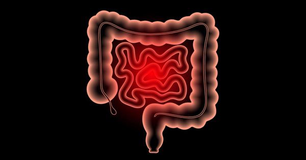 Antibióticos ligados à doença inflamatória intestinal