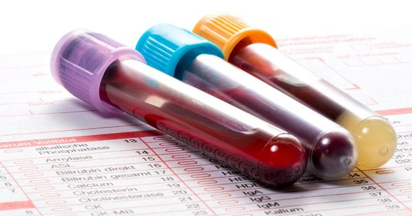 O que você recomenda testar em um exame de sangue de rotina?