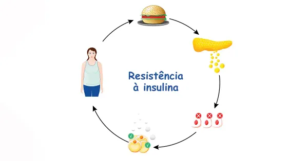Qual a conexão entre a resistência à insulina e a aceleração de doenças?