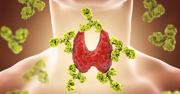 A vitamina D fortalece sua defesa imunológica contra a tireoidite de Hashimoto