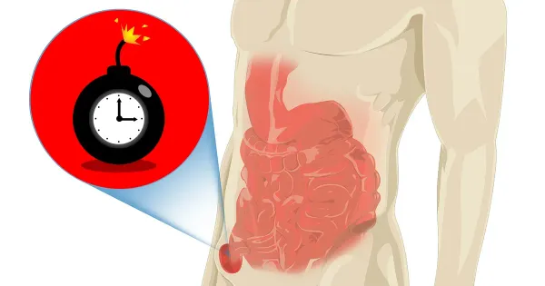 Como superar a hérnia inguinal e recuperar sua vitalidade