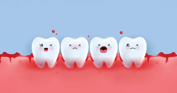 Sintomas de doenças gengivais estão ligados a um maior risco de múltiplas doenças crônicas